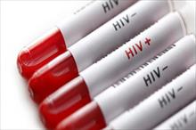 Cuba thử nghiệm thuốc phòng virus HIV/AIDS